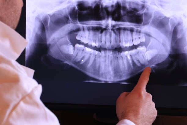 Best Pediatric Emergency Dentist in Grand Blanc, MI
