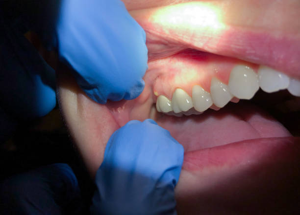 Best Orthodontic Emergency Dentist in Grand Blanc, MI