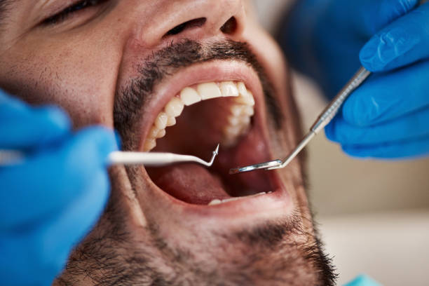 Best Broken or Cracked Tooth Emergency Dentist in Grand Blanc, MI